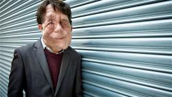 adam-pearson